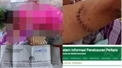 Sidang Kasus Penganiayaan Singara Binti Dg. Jama Terus Ditunda, Pemerhati Sosial Soroti Kinerja JPU Biarkan Terdakwa Mangkir