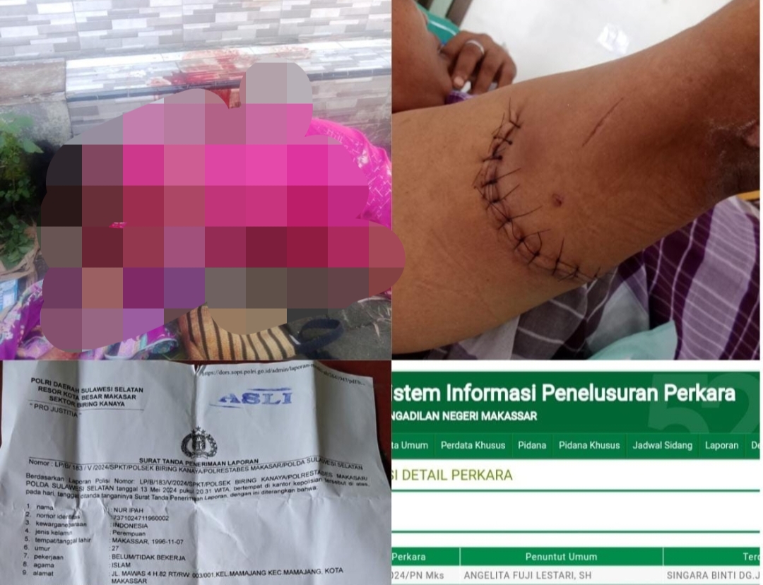 Sidang Kasus Penganiayaan Singara Binti Dg. Jama Terus Ditunda, Pemerhati Sosial Soroti Kinerja JPU Biarkan Terdakwa Mangkir