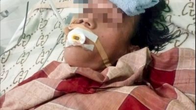 IWO Soppeng Geram, Pasien Pendarahan Otak Terlantar karena Alat Operasi Belum Tersedia